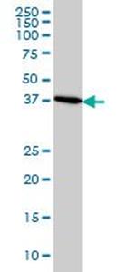 CDX4 Antibody in Western Blot (WB)