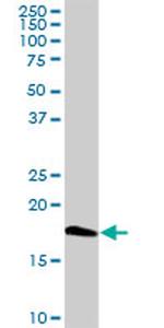 CETN1 Antibody in Western Blot (WB)