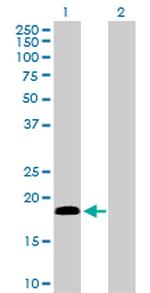 CETN1 Antibody in Western Blot (WB)