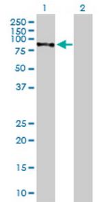 CHML Antibody in Western Blot (WB)