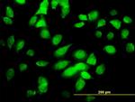 CHUK Antibody in Immunocytochemistry (ICC/IF)