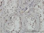 CHUK Antibody in Immunohistochemistry (Paraffin) (IHC (P))