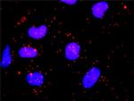 CLTC Antibody in Proximity Ligation Assay (PLA) (PLA)