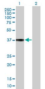 COL9A1 Antibody in Western Blot (WB)