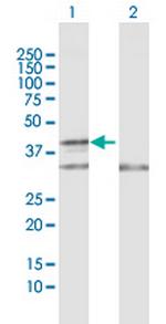 COX10 Antibody in Western Blot (WB)