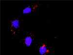 ATF2 Antibody in Proximity Ligation Assay (PLA) (PLA)