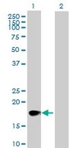 CSF2 Antibody in Western Blot (WB)