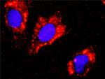 CTNNB1 Antibody in Proximity Ligation Assay (PLA) (PLA)