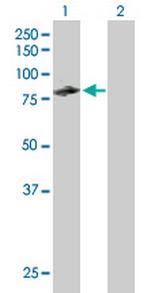 CUX1 Antibody in Western Blot (WB)