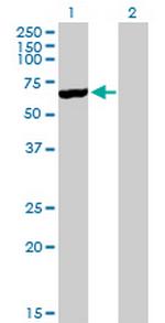 CYP3A5 Antibody in Western Blot (WB)