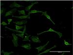 DAF Antibody in Immunocytochemistry (ICC/IF)