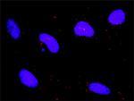 DAPK1 Antibody in Proximity Ligation Assay (PLA) (PLA)