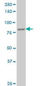 DAZ1 Antibody in Western Blot (WB)