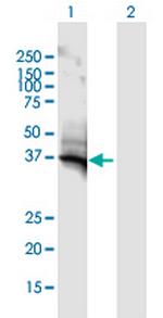 AKR1C2 Antibody in Western Blot (WB)