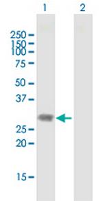 DLX1 Antibody in Western Blot (WB)