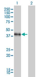 DLX3 Antibody in Western Blot (WB)