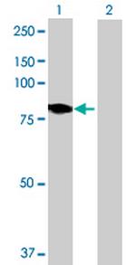 DMPK Antibody in Western Blot (WB)