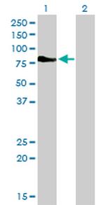 DMPK Antibody in Western Blot (WB)