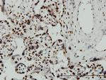 ARID3A Antibody in Immunohistochemistry (Paraffin) (IHC (P))