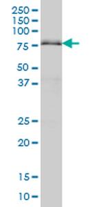 ARID3A Antibody in Western Blot (WB)