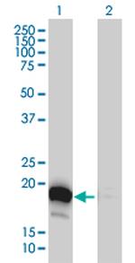 DUT Antibody in Western Blot (WB)