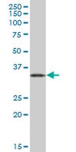 EEF1D Antibody in Western Blot (WB)