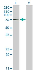 EIF4G1 Antibody in Western Blot (WB)