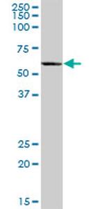 EPHX2 Antibody in Western Blot (WB)