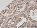 ERBB3 Antibody in Immunohistochemistry (Paraffin) (IHC (P))