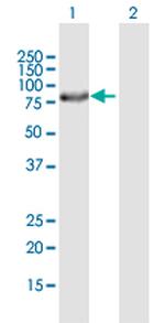 ERCC2 Antibody in Western Blot (WB)