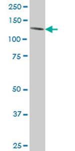 ERN1 Antibody in Western Blot (WB)