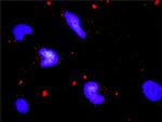 ERN1 Antibody in Proximity Ligation Assay (PLA) (PLA)