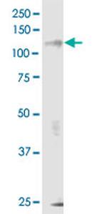 ERN1 Antibody in Western Blot (WB)