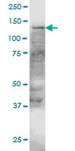 ERN1 Antibody in Western Blot (WB)