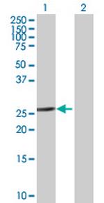 ETFB Antibody in Western Blot (WB)