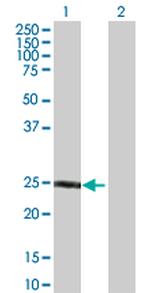 F8 Antibody in Western Blot (WB)