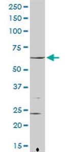 FANCG Antibody in Western Blot (WB)