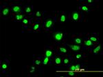 FANCG Antibody in Immunocytochemistry (ICC/IF)