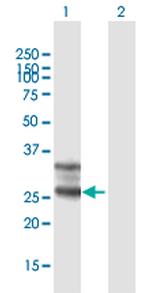 FOLR1 Antibody in Western Blot (WB)