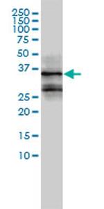 FOSL2 Antibody in Western Blot (WB)