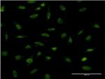 FOSL2 Antibody in Immunocytochemistry (ICC/IF)