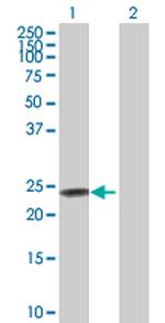 FXN Antibody in Western Blot (WB)