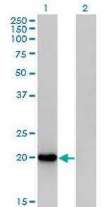 FTH1 Antibody in Western Blot (WB)