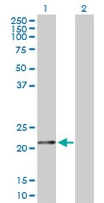 FTH1 Antibody in Western Blot (WB)