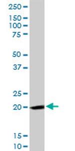 FTH1 Antibody in Western Blot (WB)