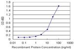 FTL Antibody in ELISA (ELISA)