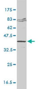 FVT1 Antibody in Western Blot (WB)