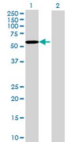 FYN Antibody in Western Blot (WB)