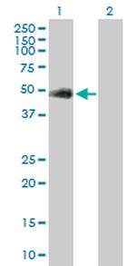 GAK Antibody in Western Blot (WB)