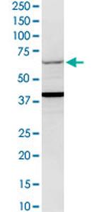 GCK Antibody in Western Blot (WB)